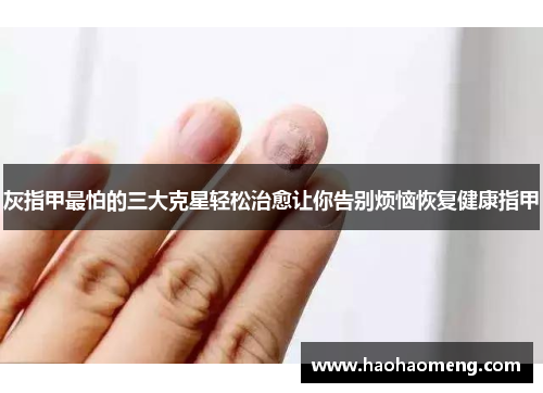 灰指甲最怕的三大克星轻松治愈让你告别烦恼恢复健康指甲
